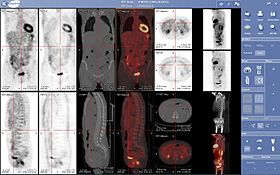 pet-ct